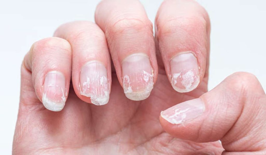Comment retirer ses capsules sans fragiliser ses ongles naturels ?
