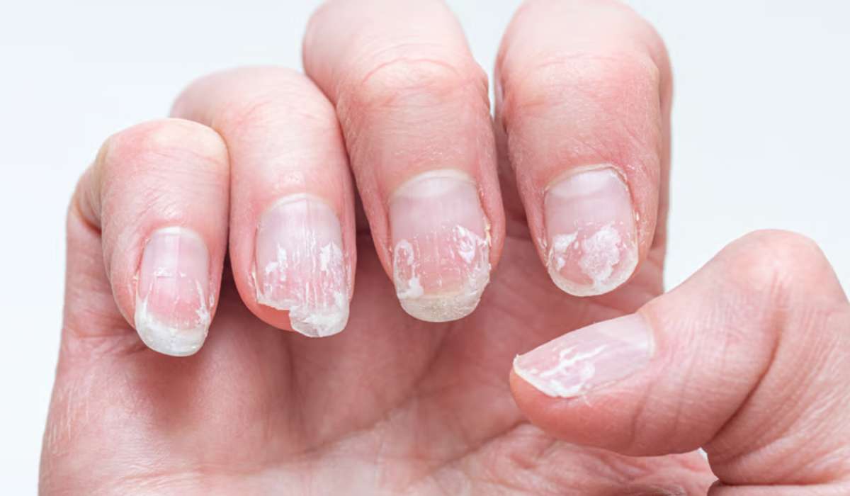 Comment retirer ses capsules sans fragiliser ses ongles naturels ?